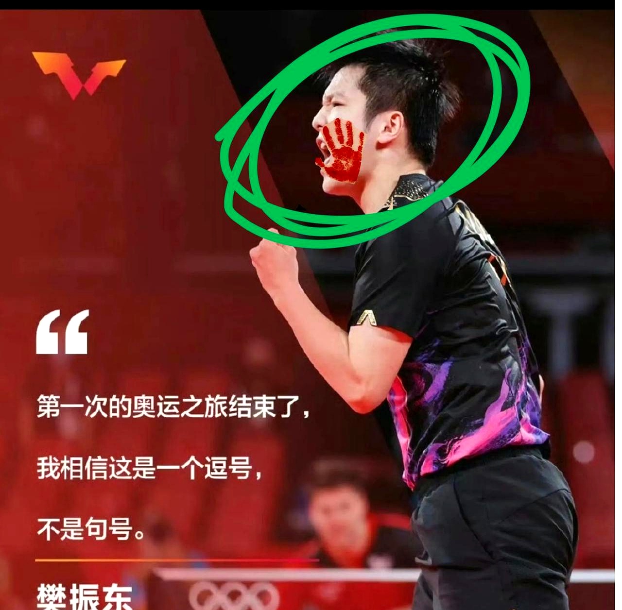 爱游戏-国乒在比赛中受伤退赛，恒大主帅表示担忧！(国乒在比赛中受伤退赛,恒大主帅表示担忧了吗)